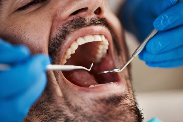 Best Weekend Emergency Dental Services in Murphys, CA